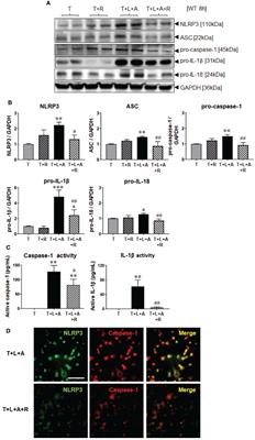 Relaxin Can Mediate Its Anti-Fibrotic Effects by Targeting the Myofibroblast NLRP3 Inflammasome at the Level of Caspase-1